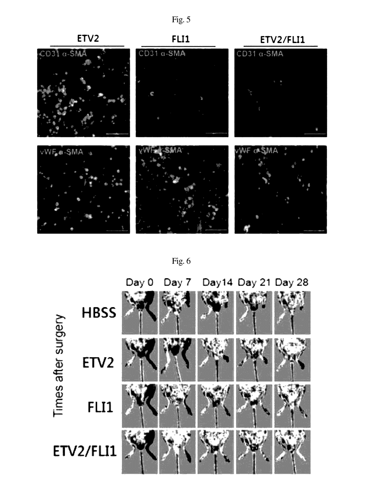 Composition for inducing direct transdifferentiation of somatic cell into vascular progenitor cell, and use thereof