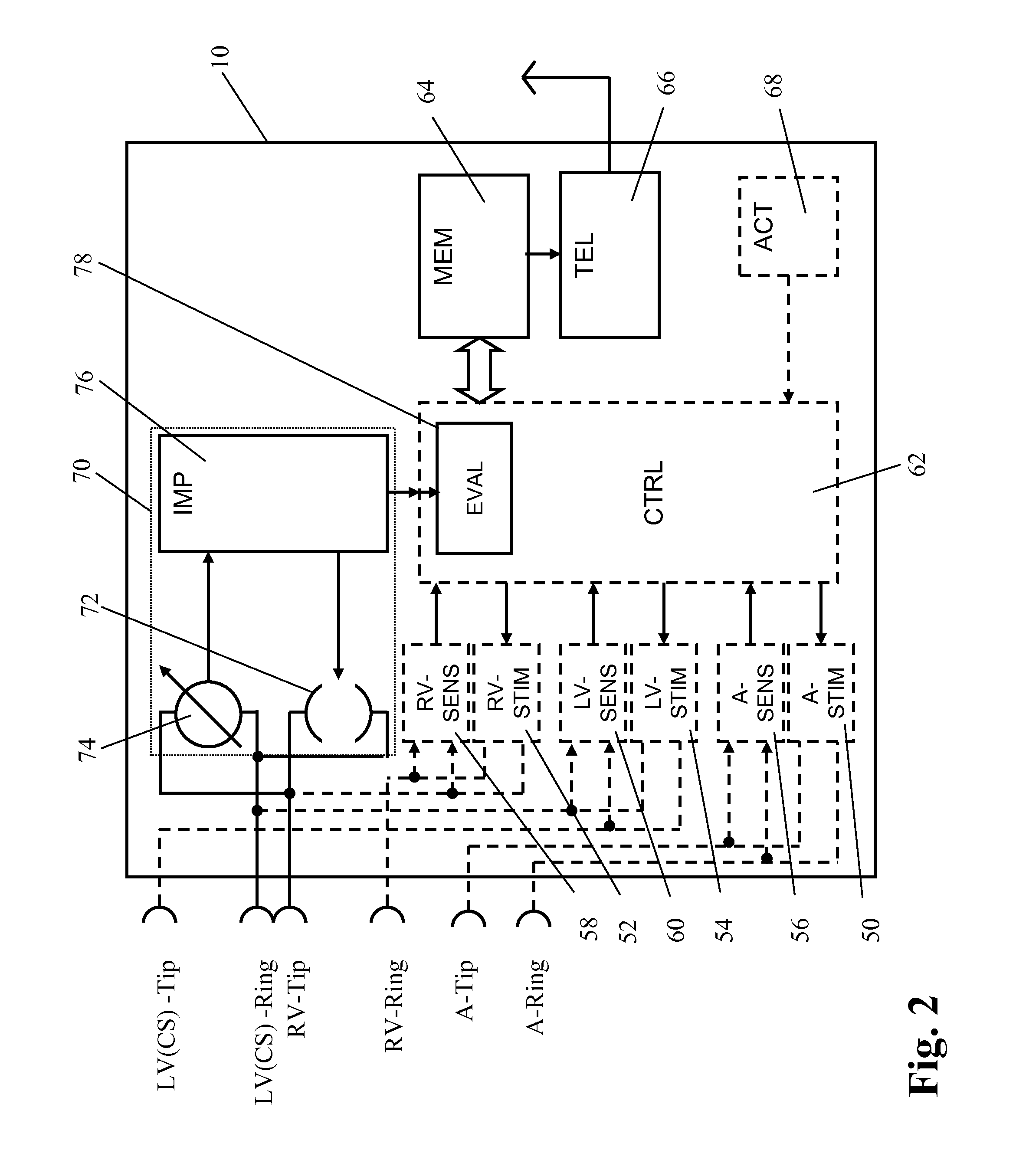 Apparatus and method to optimize pacing parameters