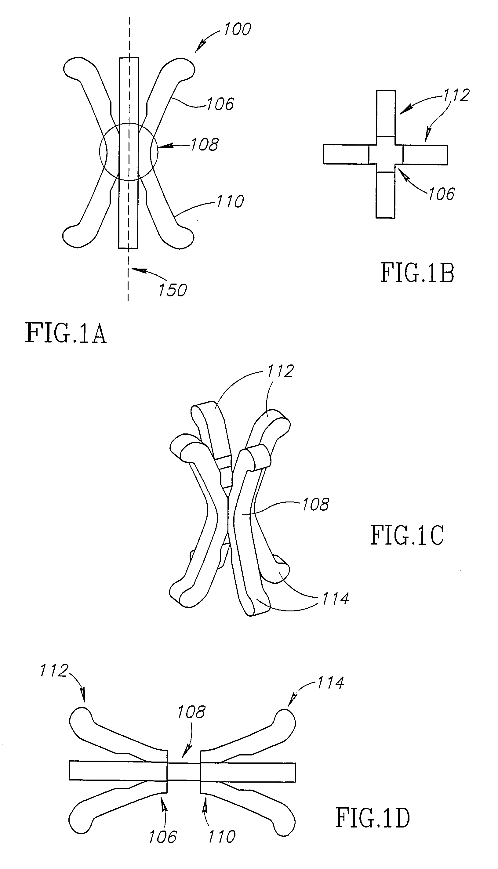 Apparatus for the Prevention of Urinary Incontinence in Females