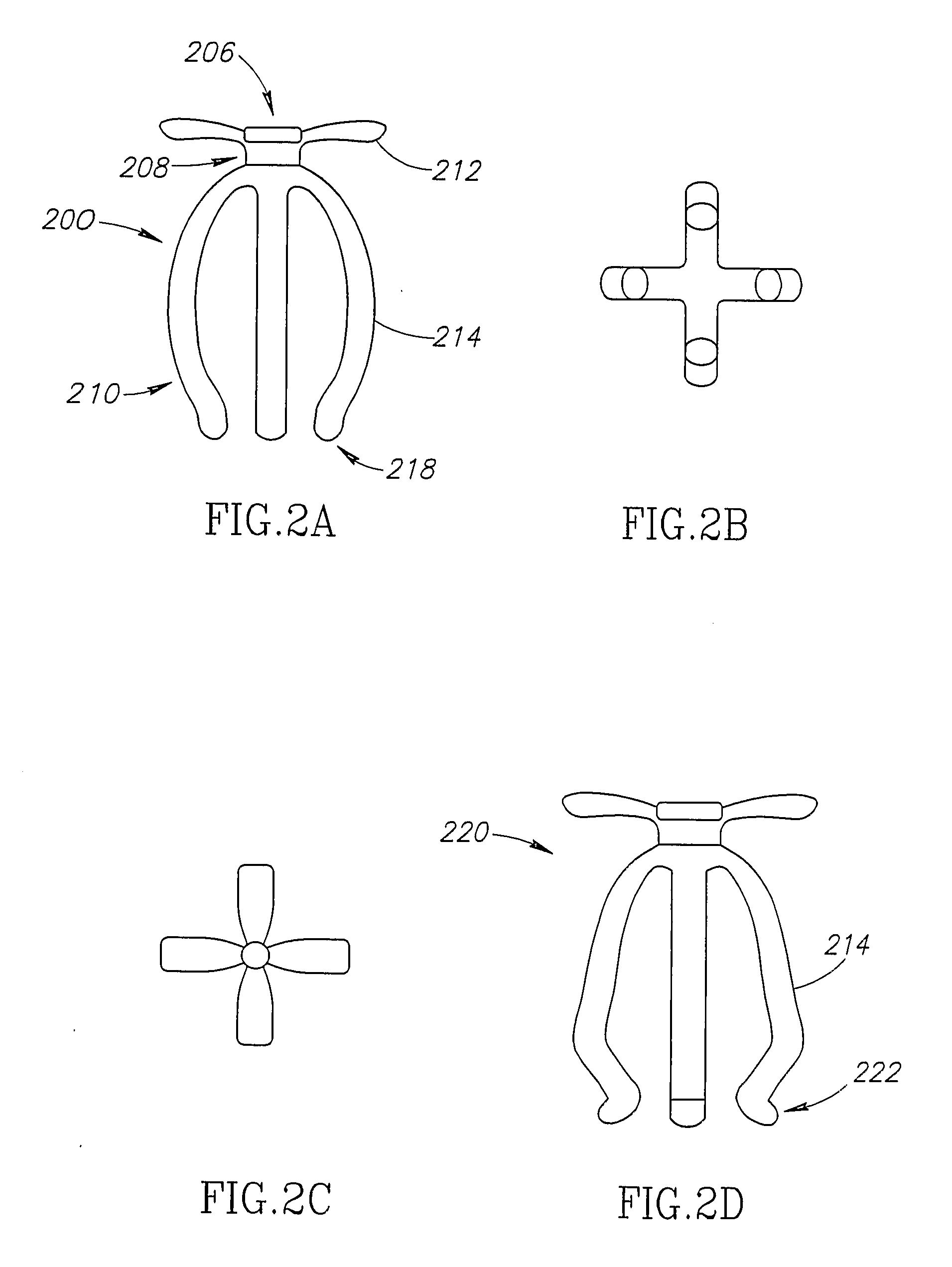 Apparatus for the Prevention of Urinary Incontinence in Females