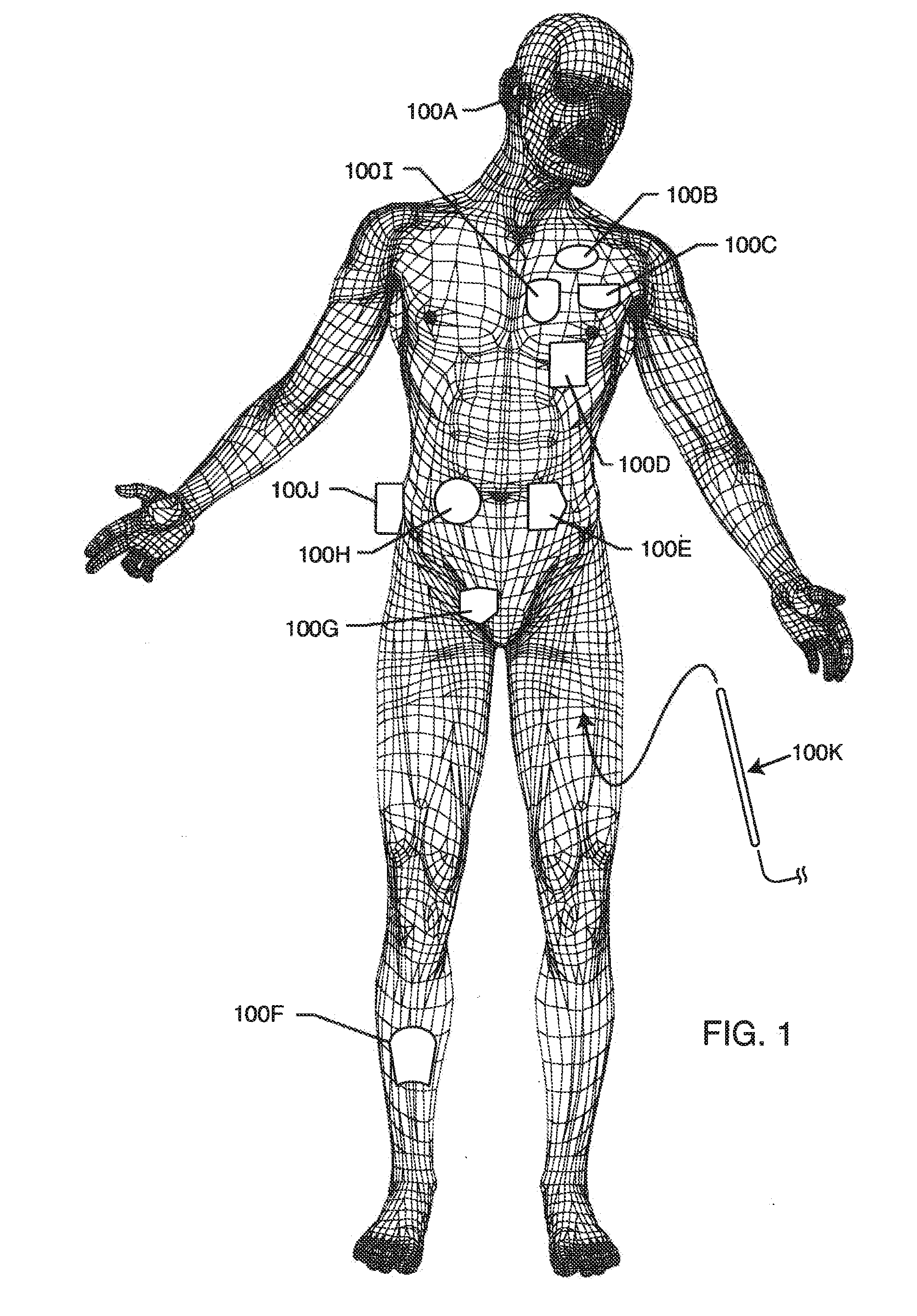 EMI filter employing a self-resonant inductor bandstop filter having optimum inductance and capacitance values