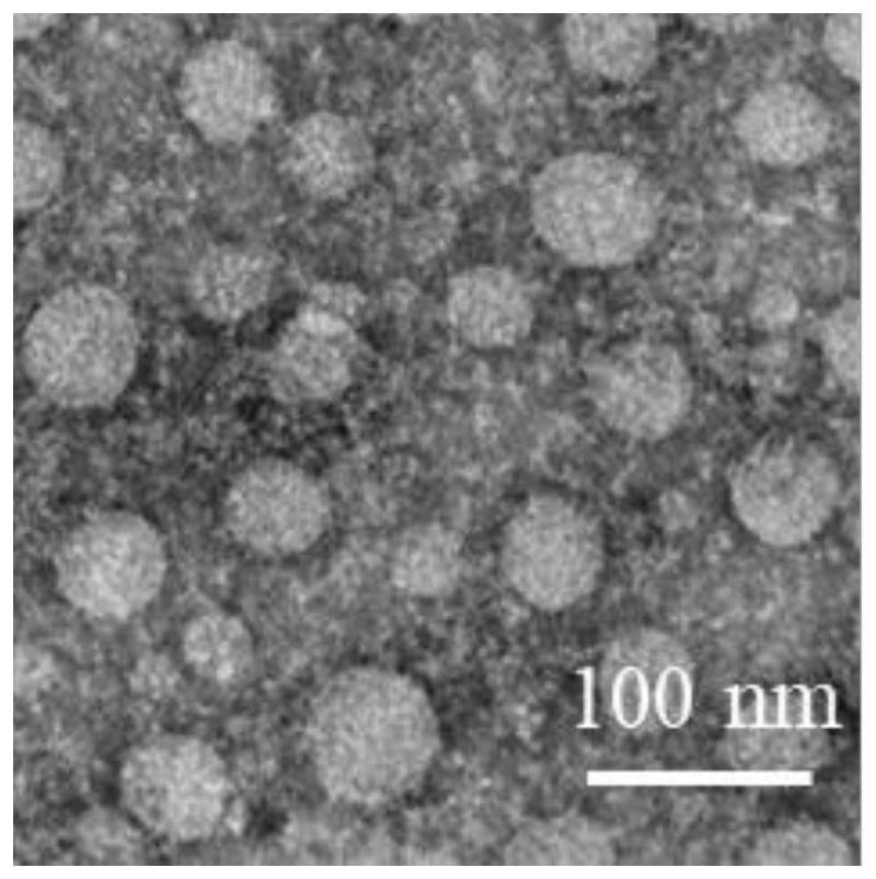 Nanocomposite of erythrocyte membrane coated functional molecules, preparation method and application