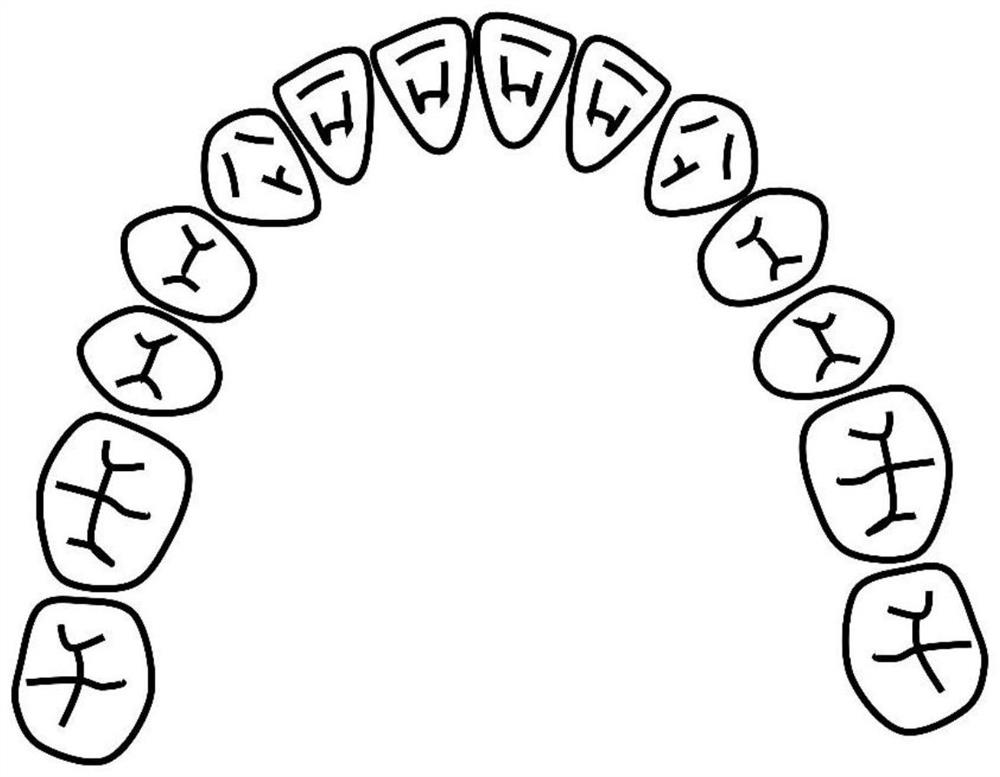 Novel maxillary arch expander for bilateral cleft lip and palate patient and correction method