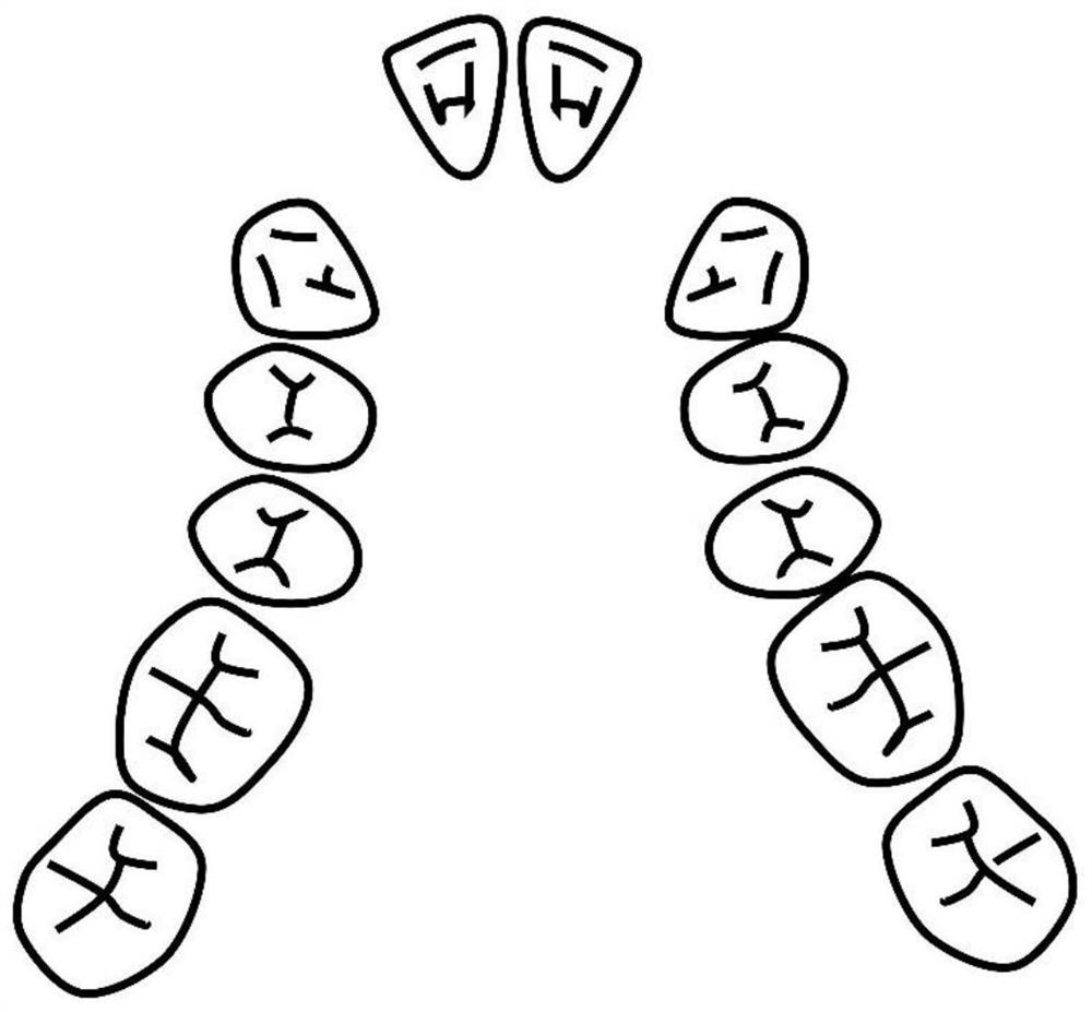 Novel maxillary arch expander for bilateral cleft lip and palate patient and correction method