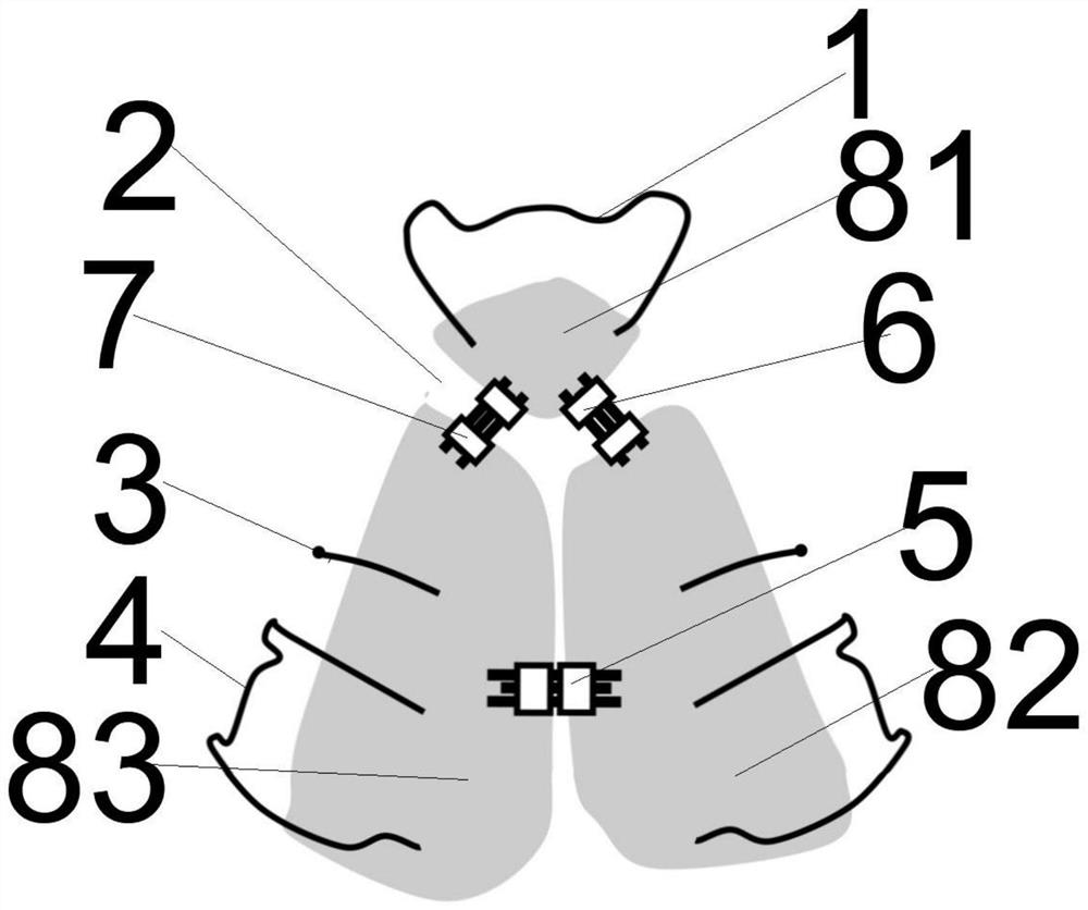 Novel maxillary arch expander for bilateral cleft lip and palate patient and correction method