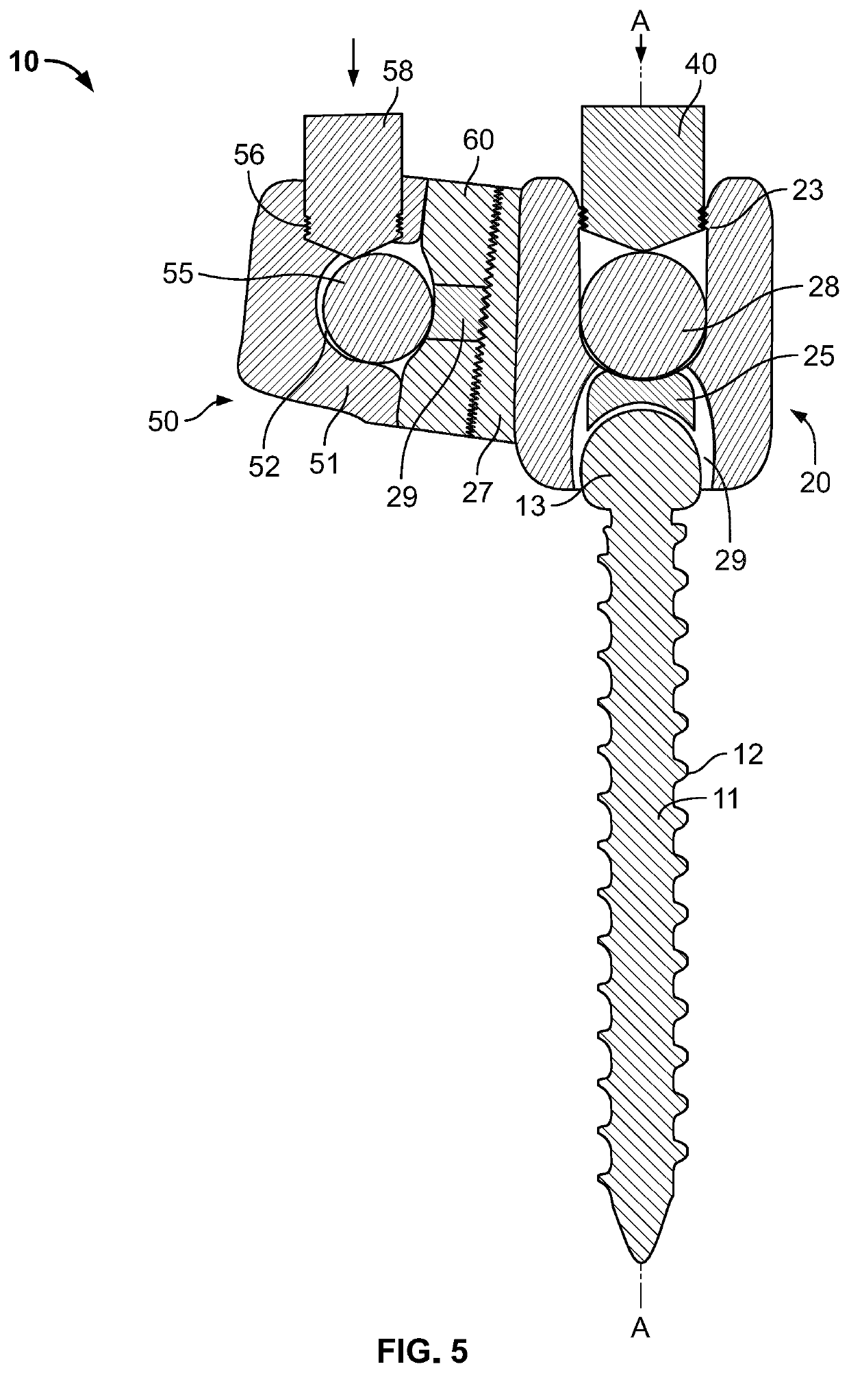 Spinal fixation device with rotatable connector