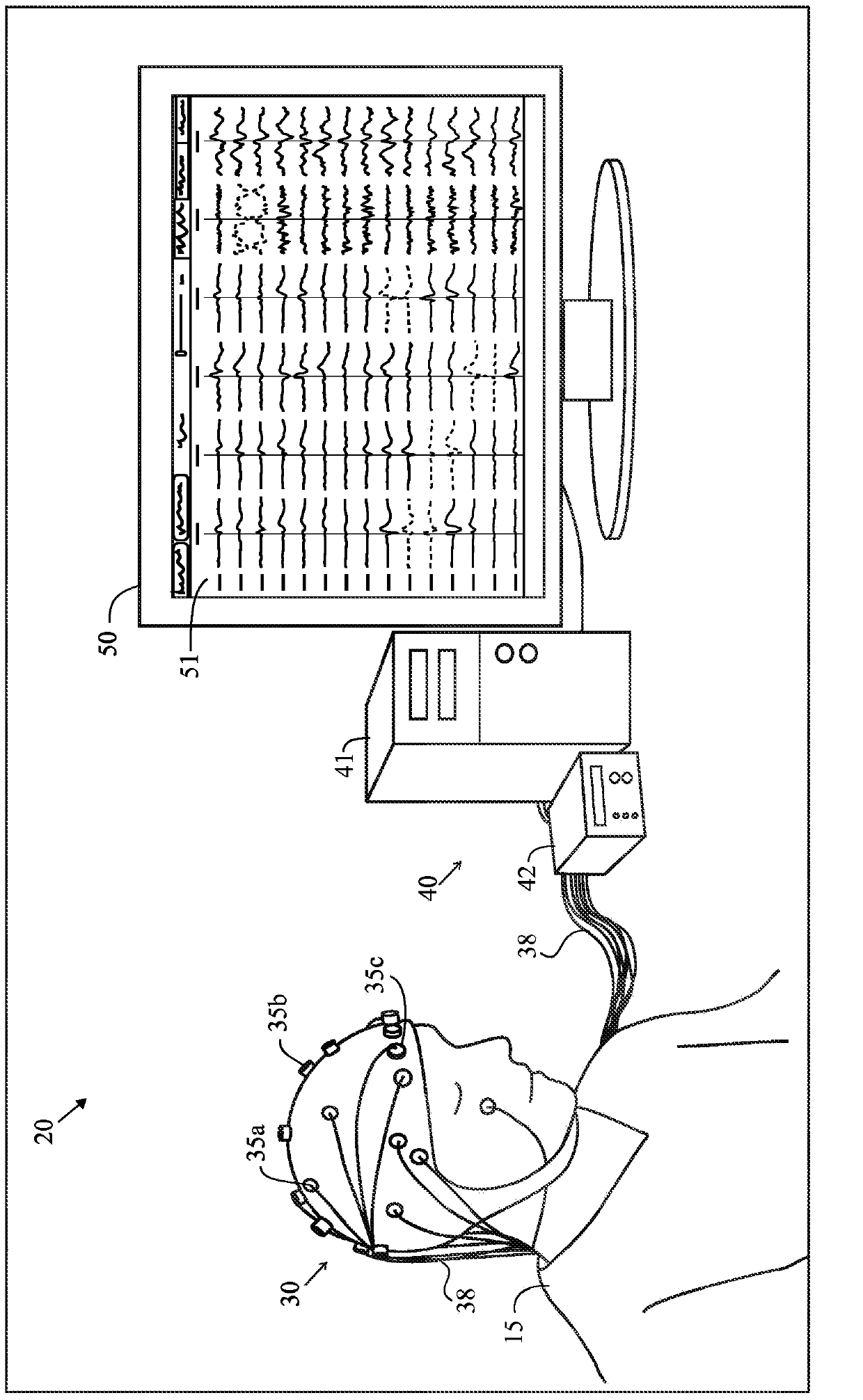 Method and system for analyzing an eeg recording