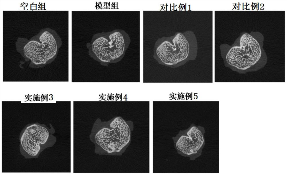 Composition beneficial for promoting bone health and application of composition