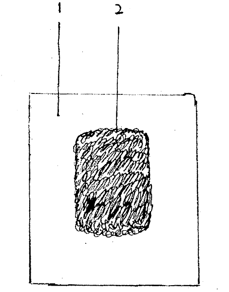 Arch plasters for treating mallnutrition and indigestion syndrome in children