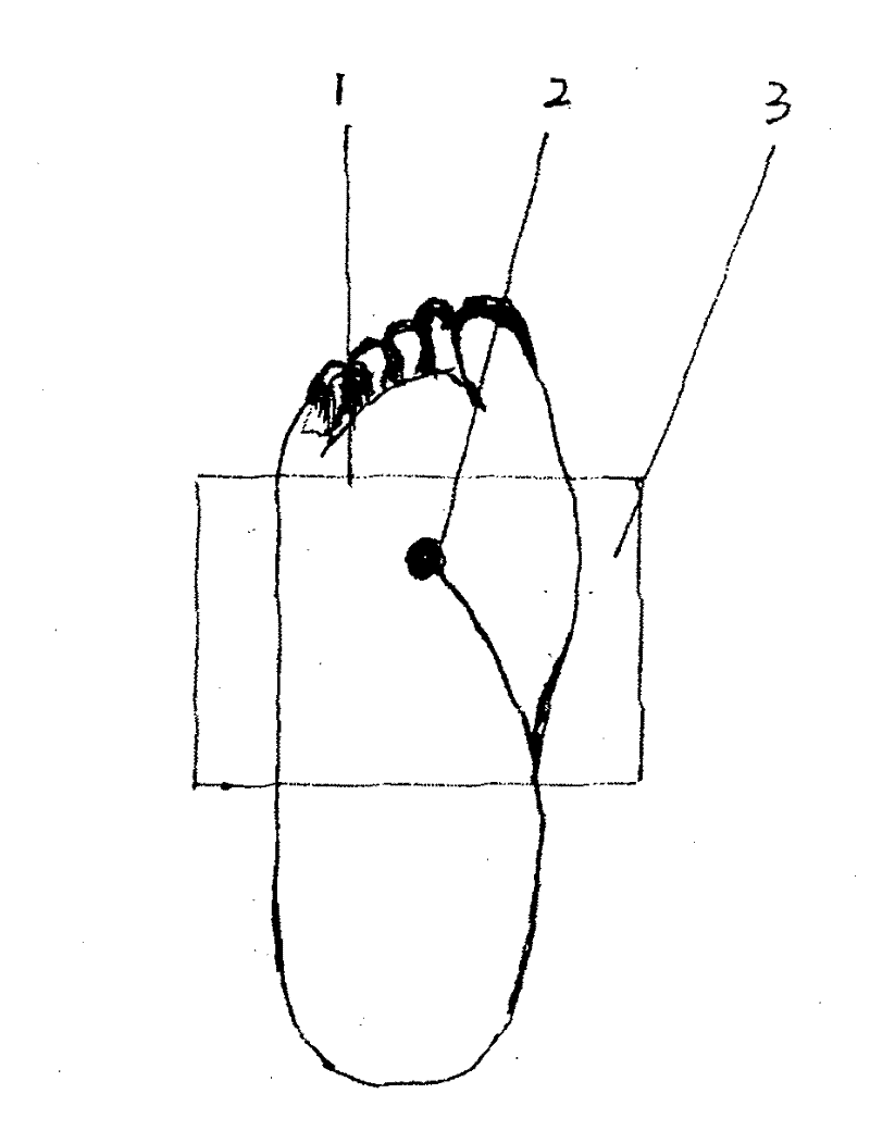 Arch plasters for treating mallnutrition and indigestion syndrome in children