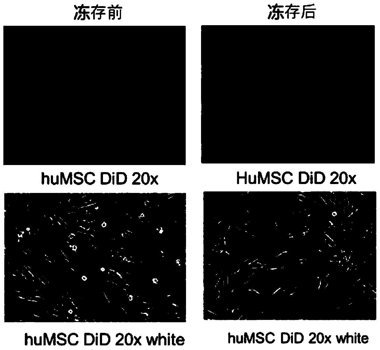 Cryoprotectant for umbilical cord mesenchymal stem cells and application of cryoprotectant