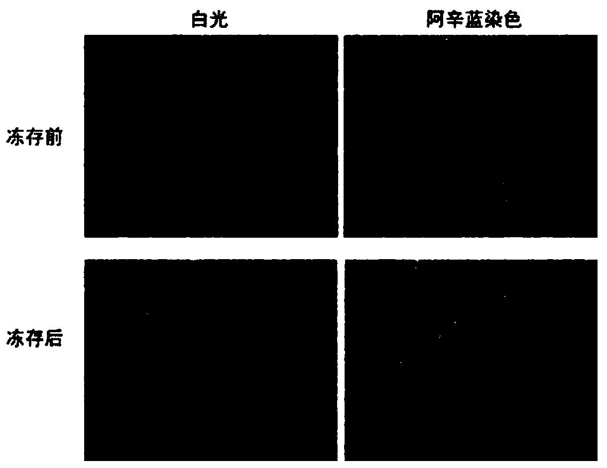 Cryoprotectant for umbilical cord mesenchymal stem cells and application of cryoprotectant