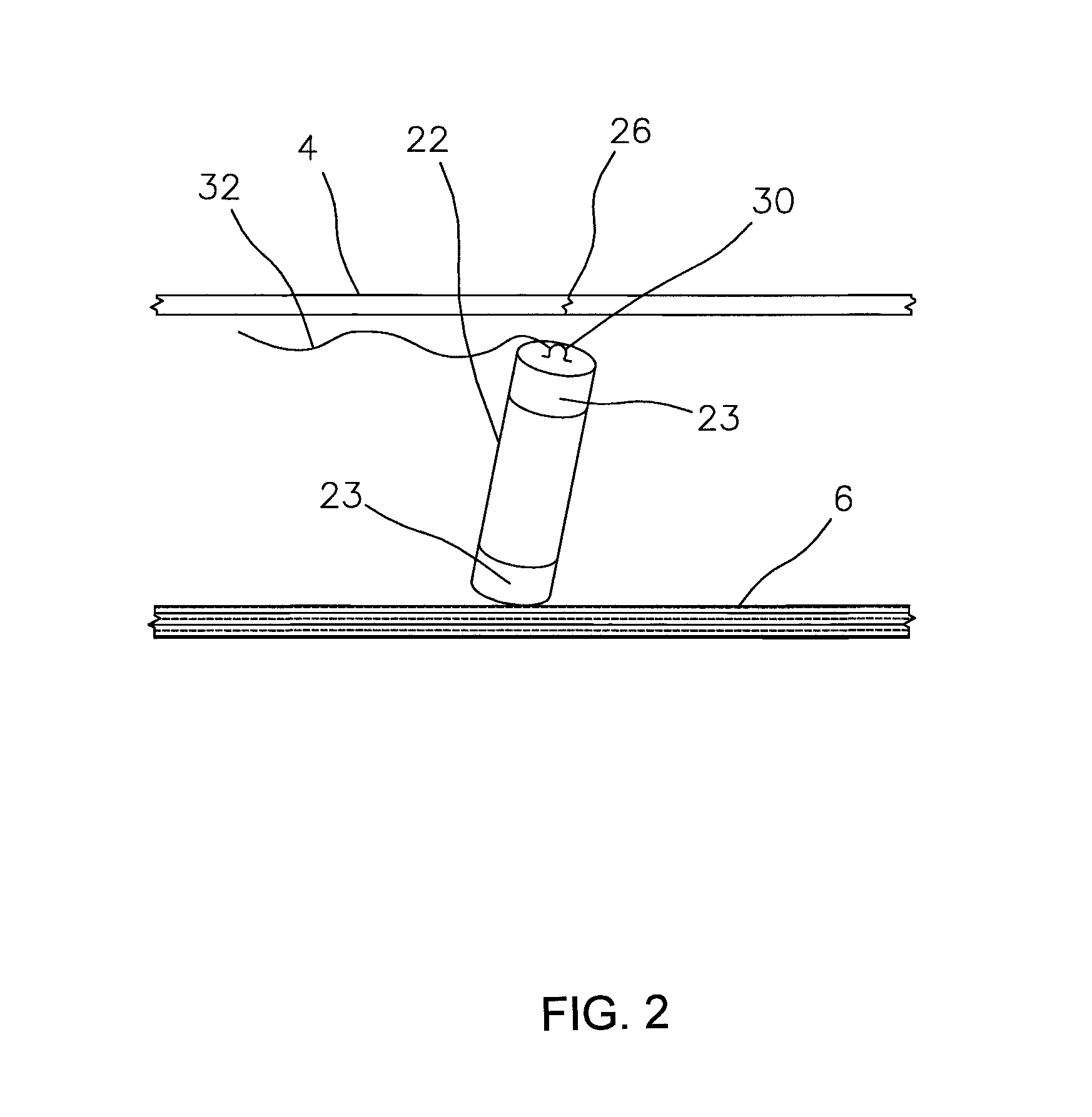 Method for removing surgically implanted devices