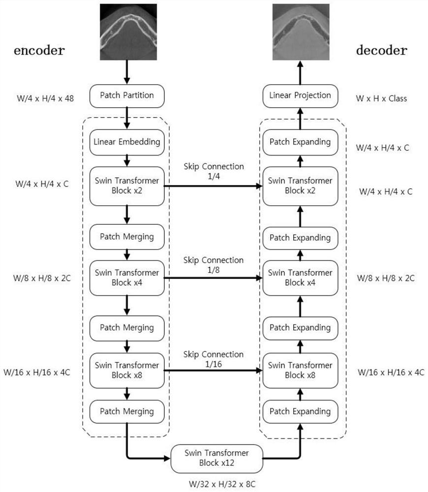 CBCT alveolar bone segmentation system and method based on deep learning