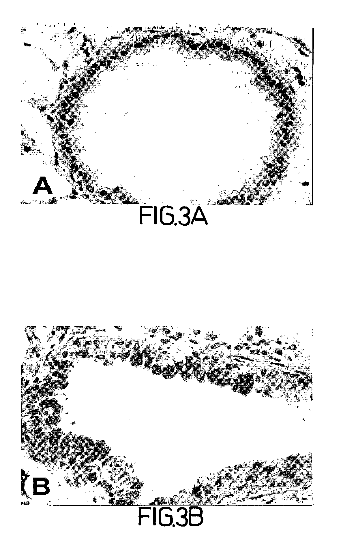 Methods, compositions and kits relating to chitinases and chitinase-like molecules and inflammatory disease