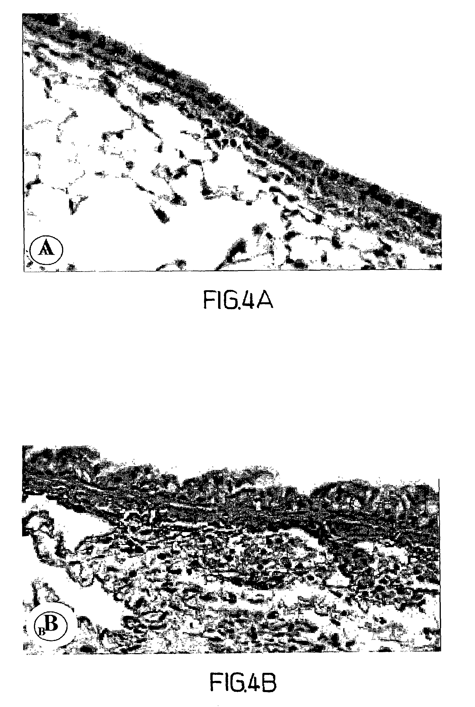 Methods, compositions and kits relating to chitinases and chitinase-like molecules and inflammatory disease