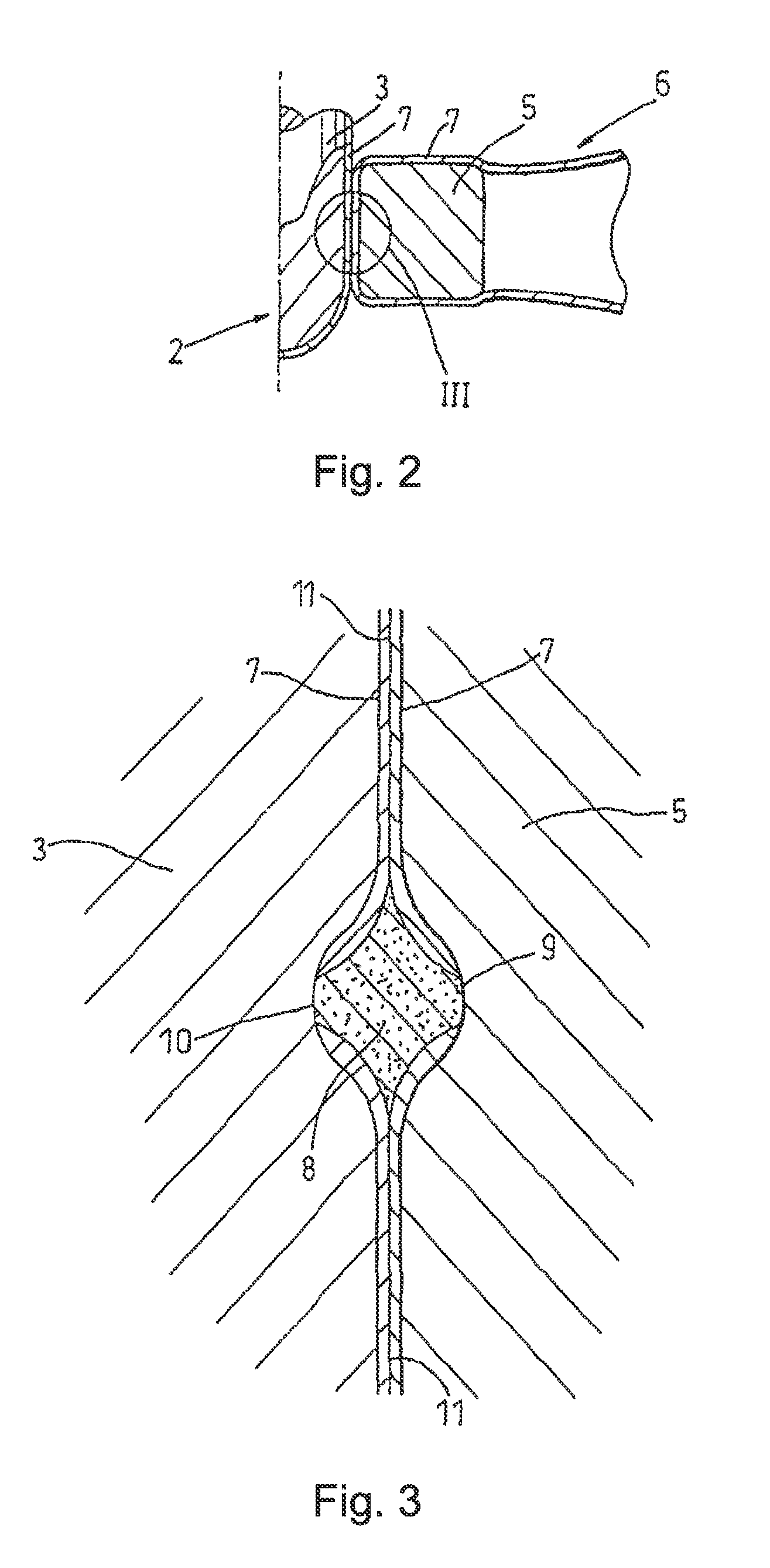 Electrical connection between conductive elements