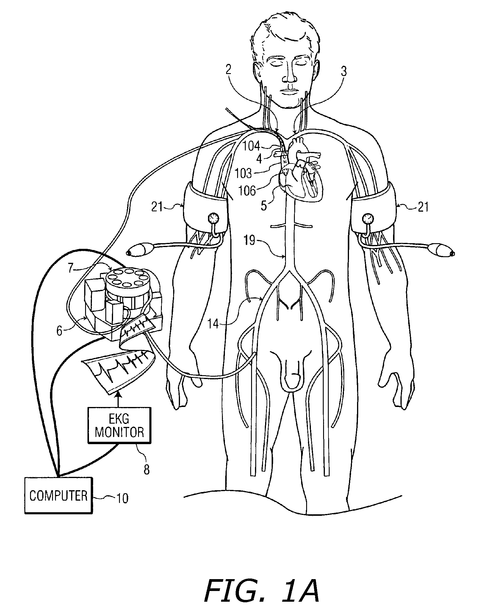 System, methods and apparatus for cerebral protection