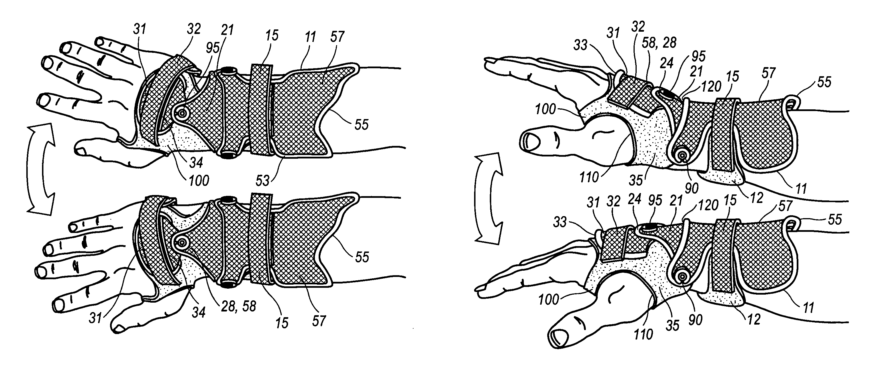 Orthotic protective device