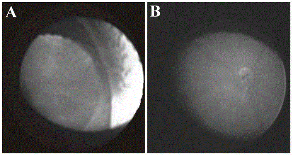 Application of flavonoids compounds in preparation of T lymphocyte subsets regulating drug