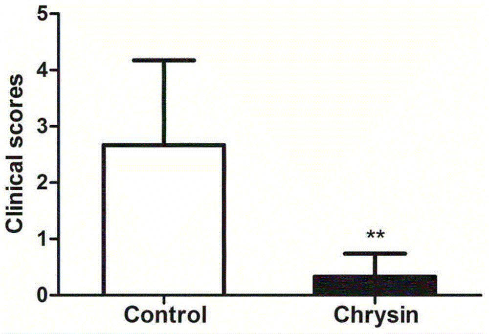 Application of flavonoids compounds in preparation of T lymphocyte subsets regulating drug