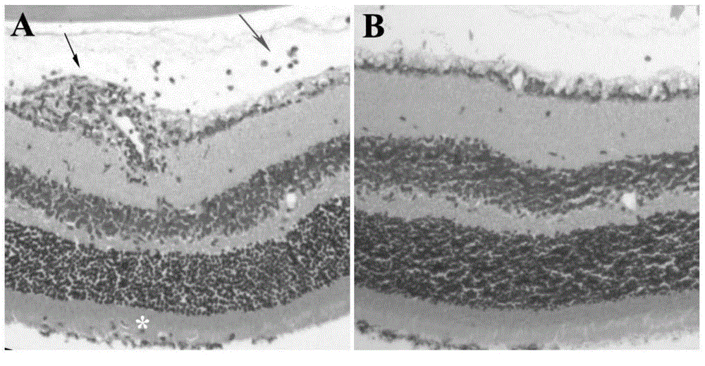 Application of flavonoids compounds in preparation of T lymphocyte subsets regulating drug