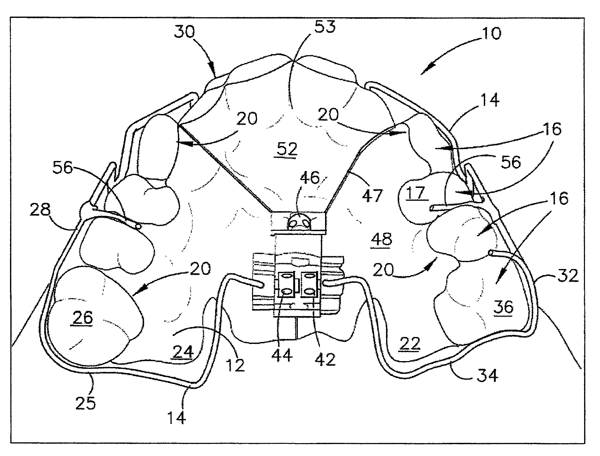 Dental appliance