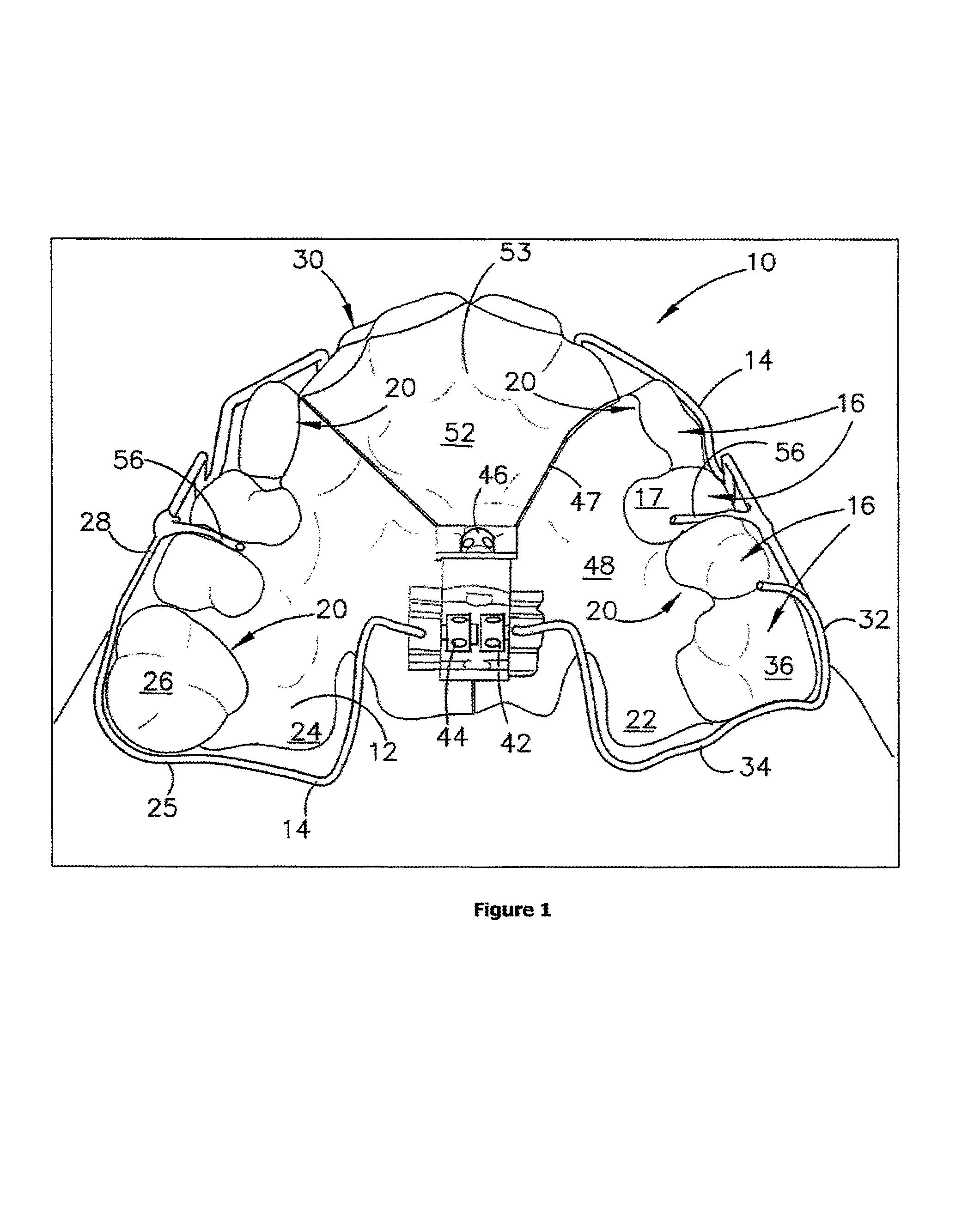 Dental appliance