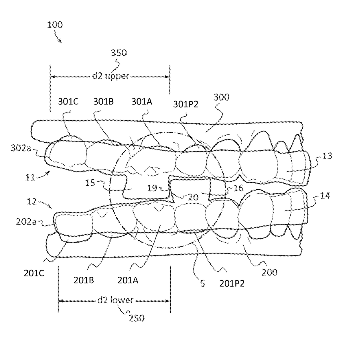 Oral apparatuses and methods for mandibular jaw manipulation