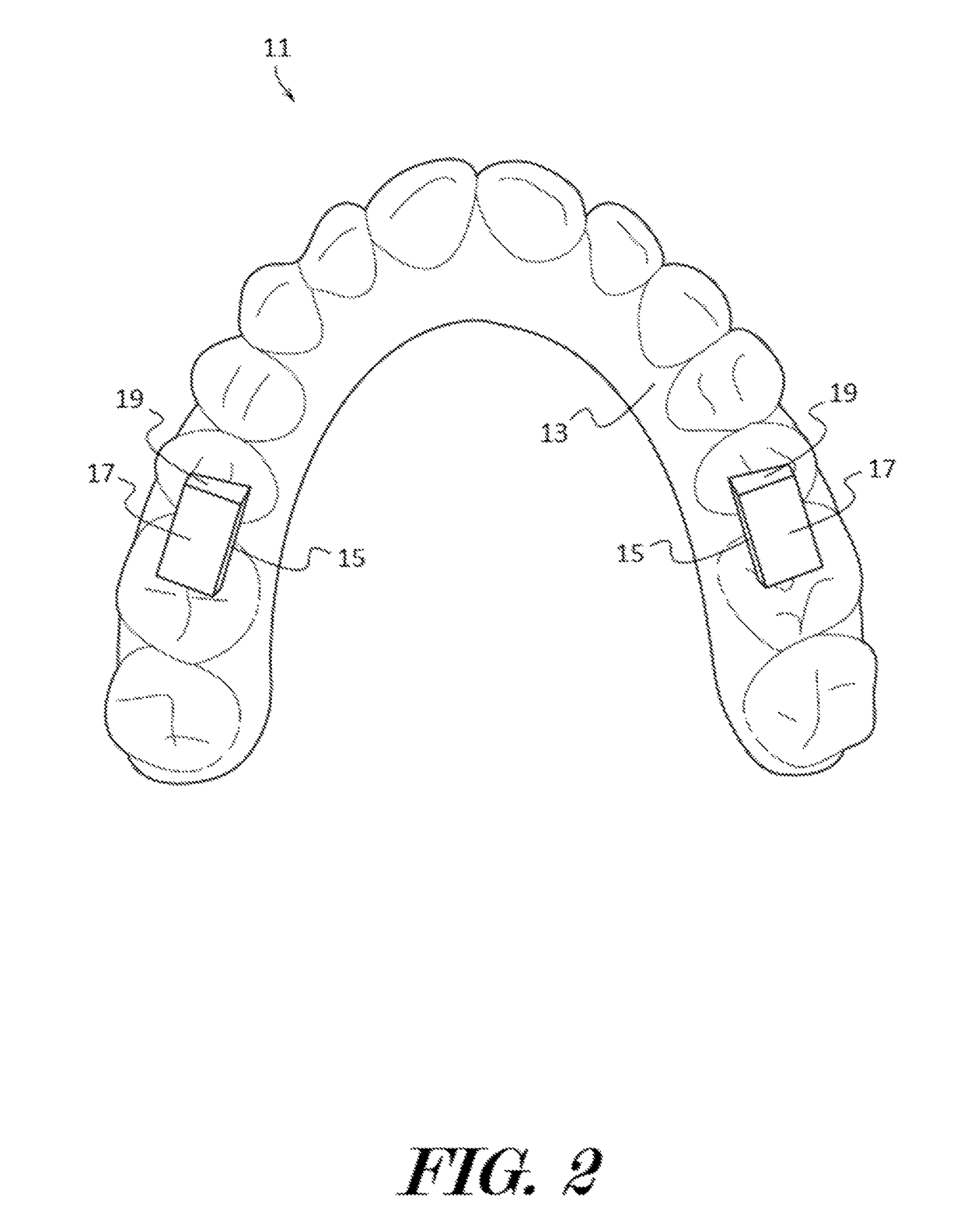 Oral apparatuses and methods for mandibular jaw manipulation