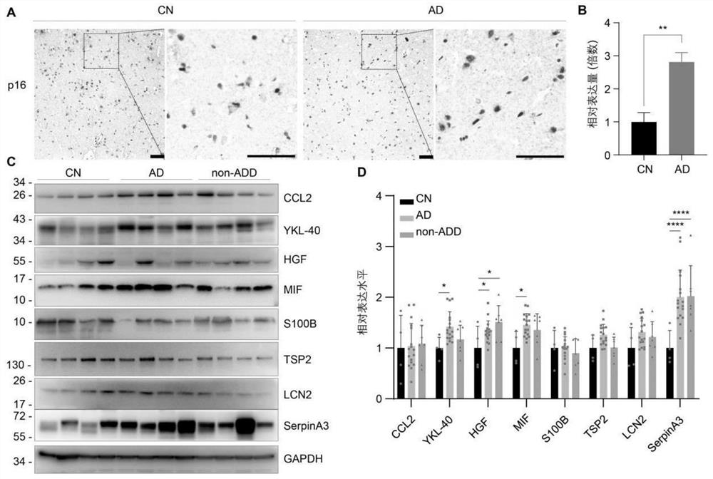 Biomarker related to senescence glial cells and application of biomarker in diagnosis of Alzheimer's disease