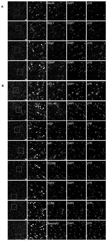 Biomarker related to senescence glial cells and application of biomarker in diagnosis of Alzheimer's disease