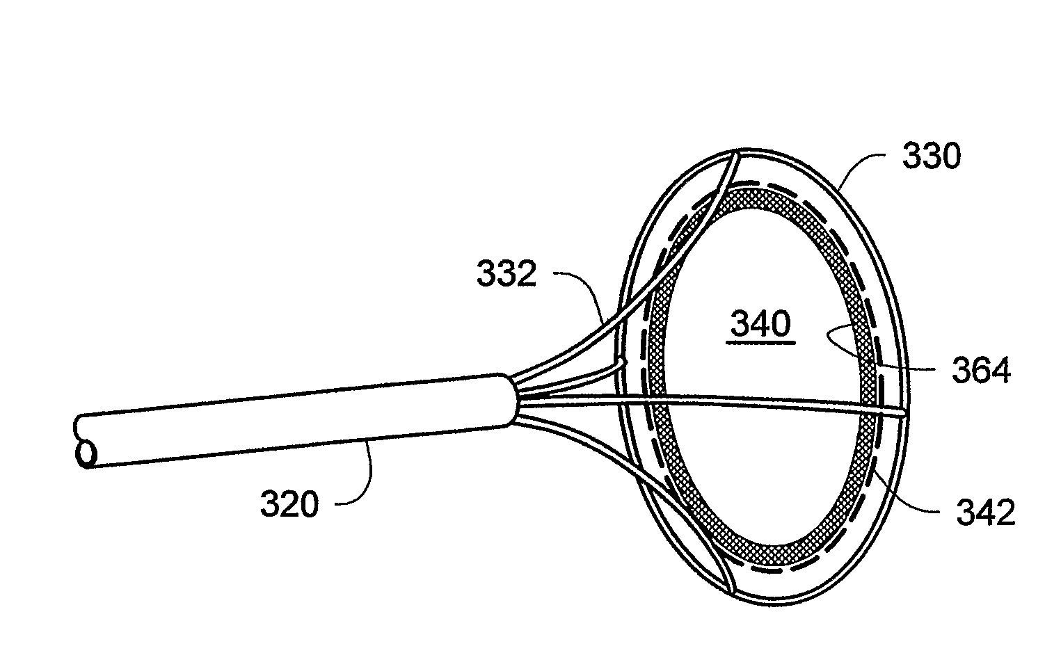 Implantable closure apparatus and methods