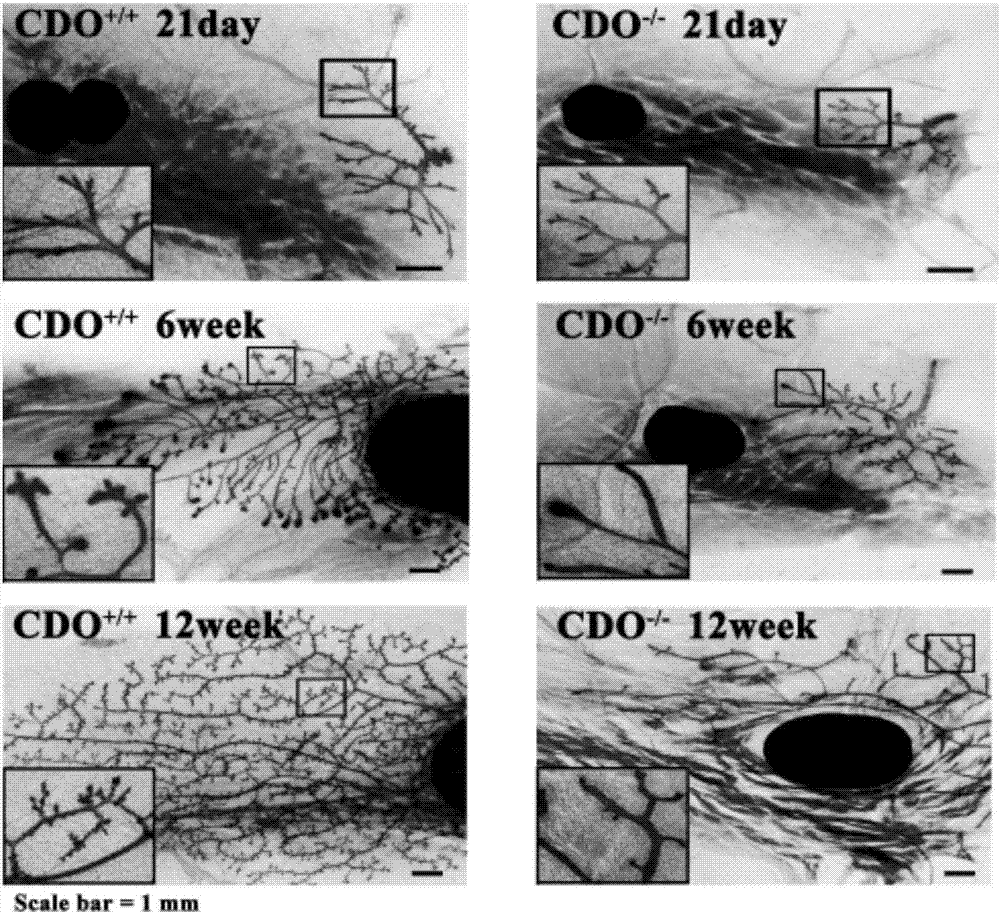 Novel application of cysteine dioxygenase, gene and catalysate cysteine sulfinic acid of cysteine dioxygenase