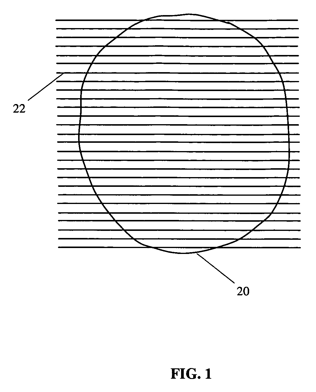 Registration of three dimensional image data with X-ray imaging system