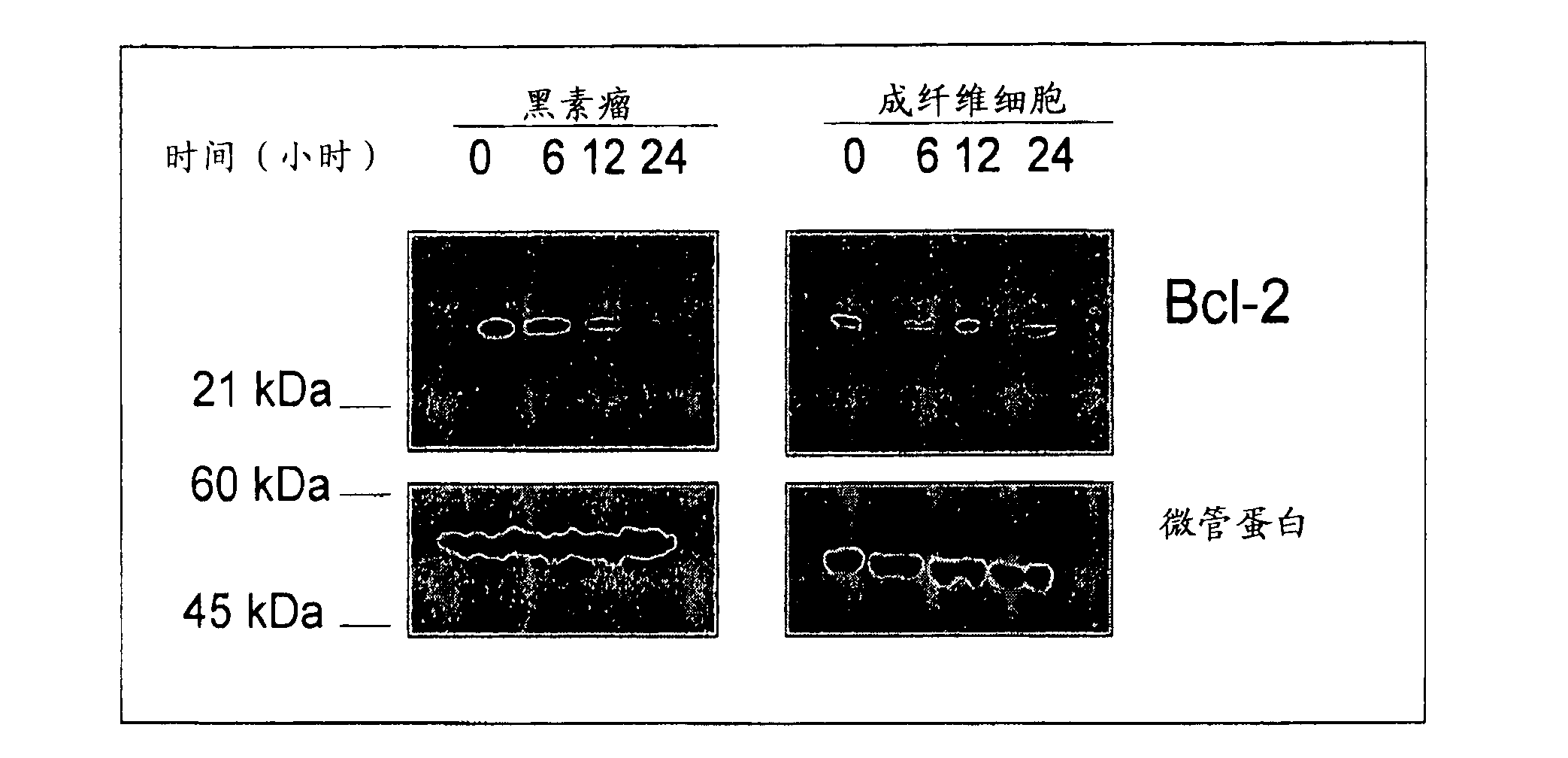 Methods and use of inducing apoptosis in cancer cells