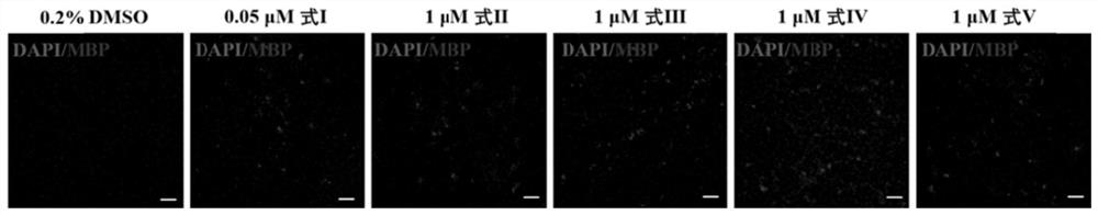 Application of compounds in preparation of medicine for treating and/or preventing demyelination diseases