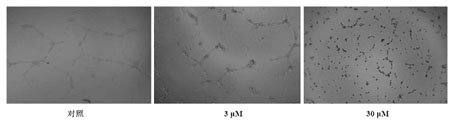 Application of carnosic acid in preparing medicament for suppressing angiogenesis