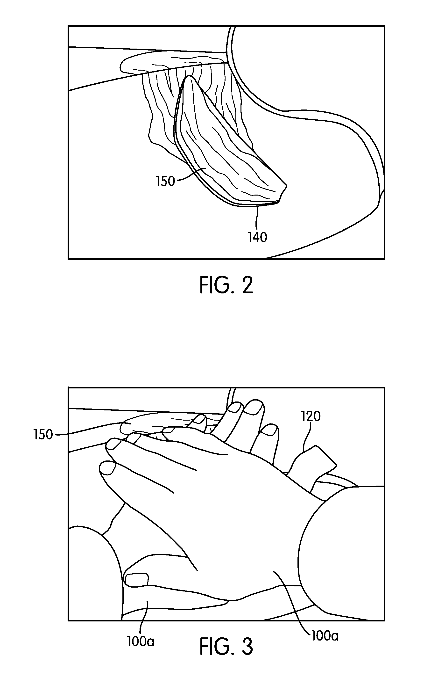 Hemorrhage control simulator