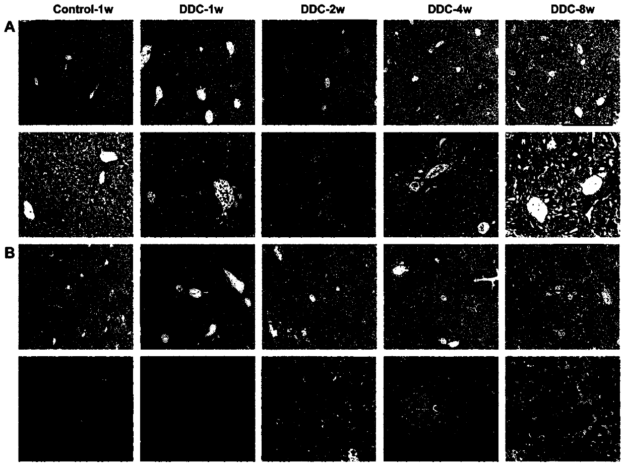 Marker and kit for early hepatic fibrosis diagnosis and application