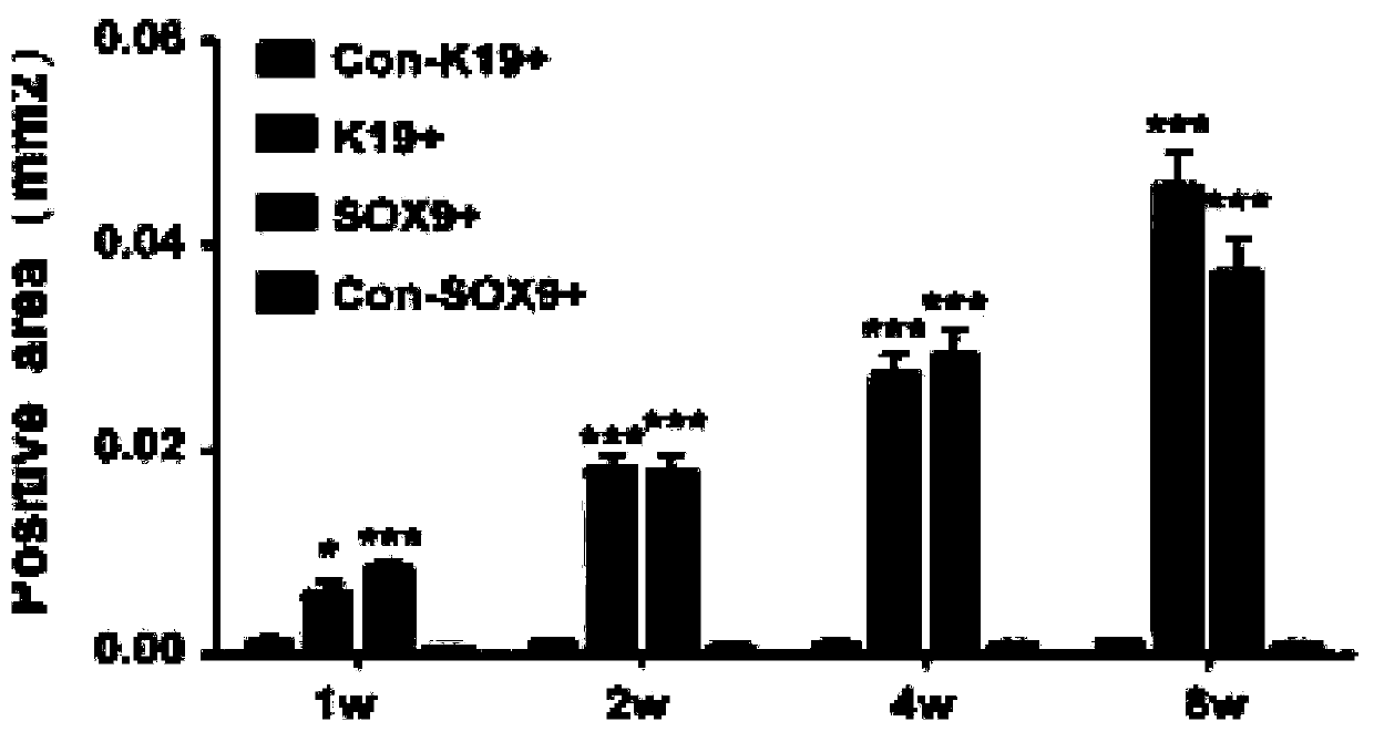 Marker and kit for early hepatic fibrosis diagnosis and application