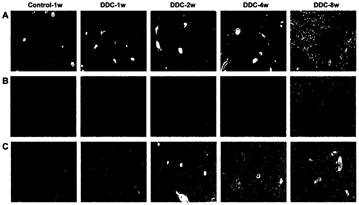 Marker and kit for early hepatic fibrosis diagnosis and application