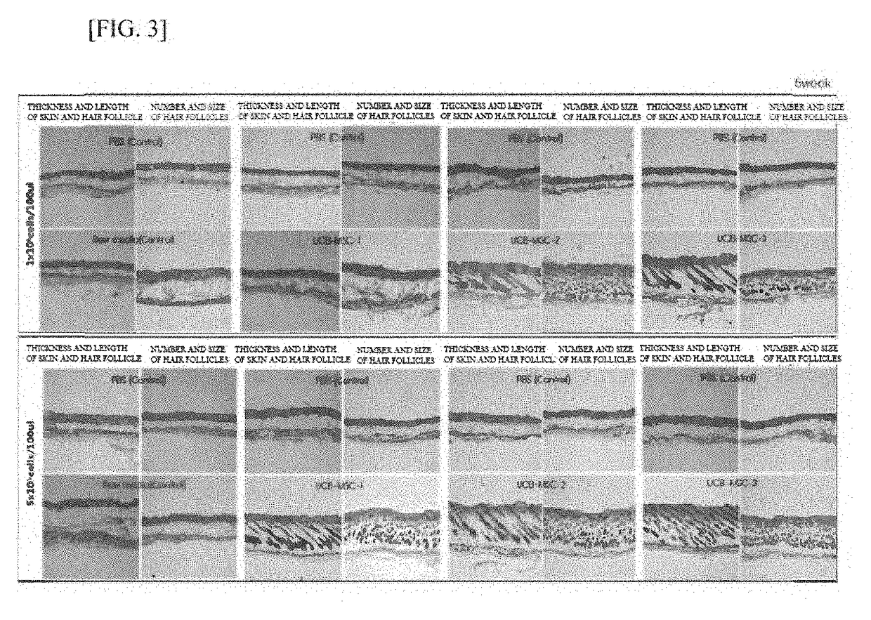 Capability of small-sized stem cells to stimulate hair growth and use thereof