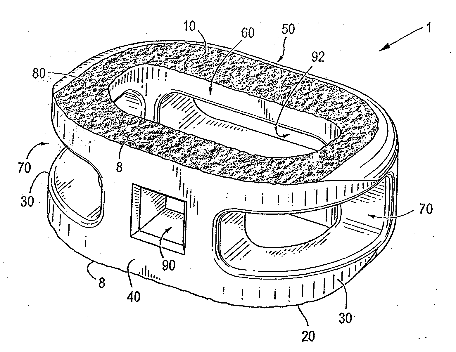 Spinal implant having variable ratios of the integration surface area to the axial passage area