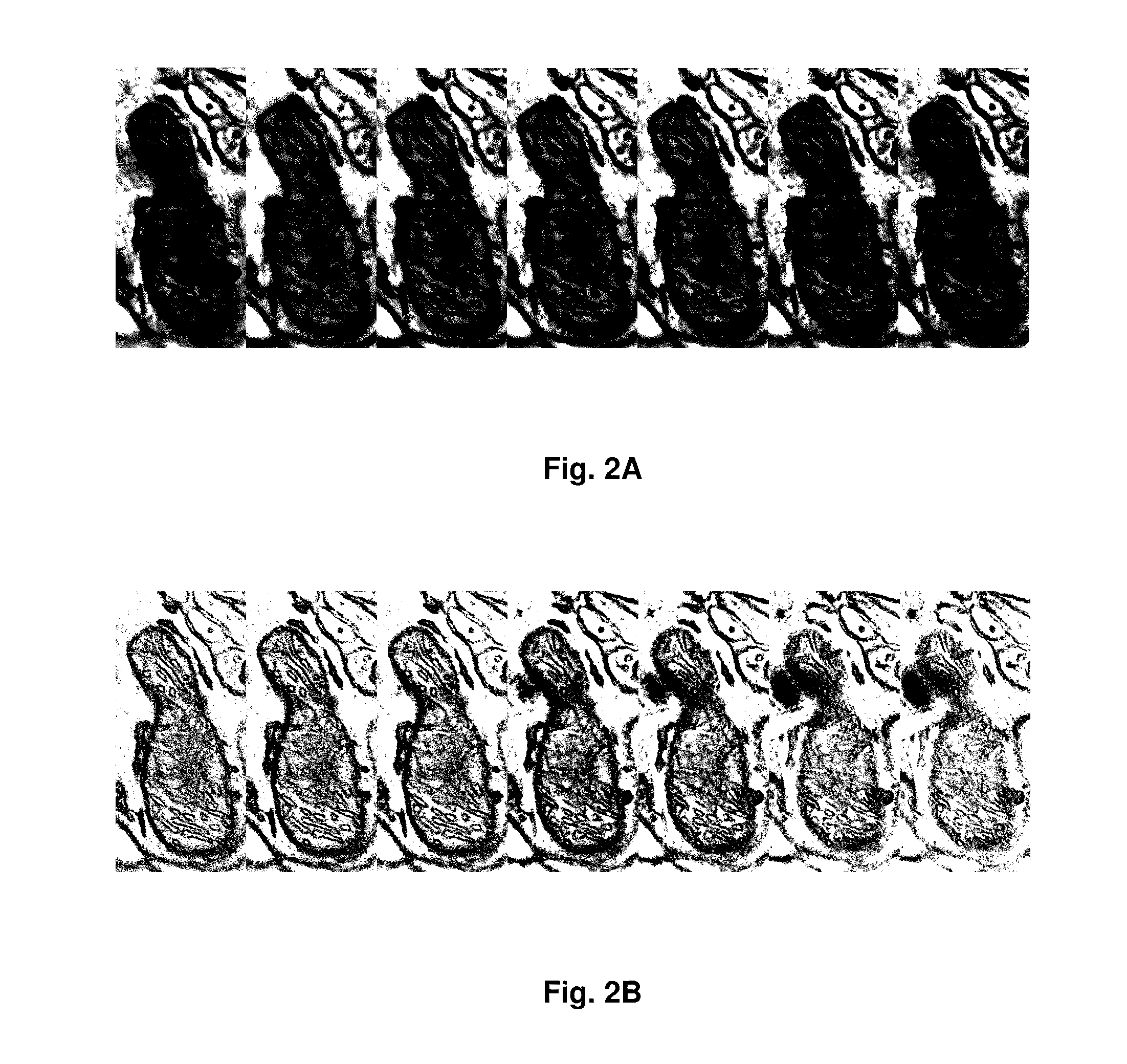 SEM Imaging Method