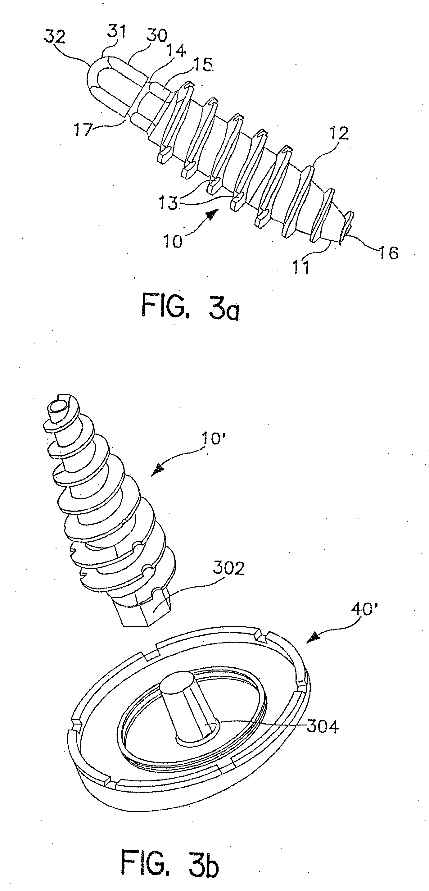 System and Method for Joint Resurface Repair