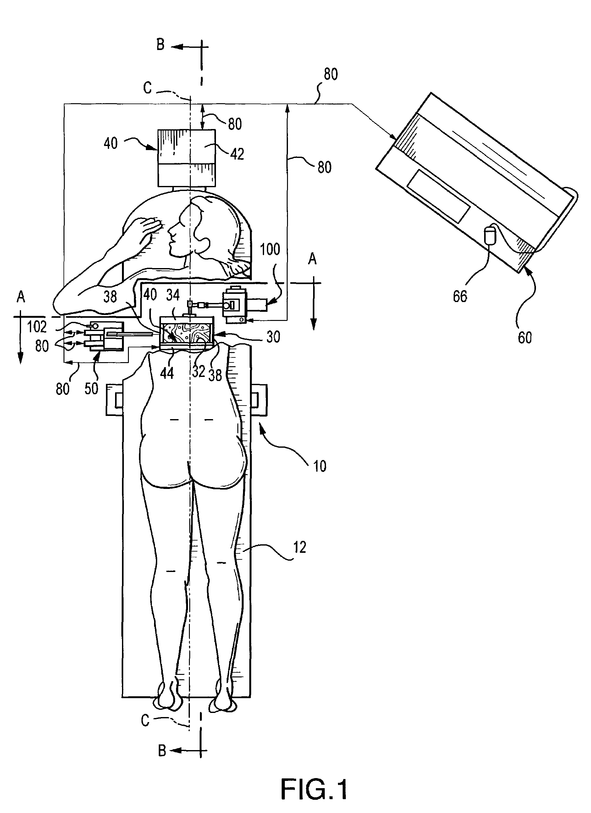 Spatially correlated x-ray and ultrasound mammographic imaging systems and method