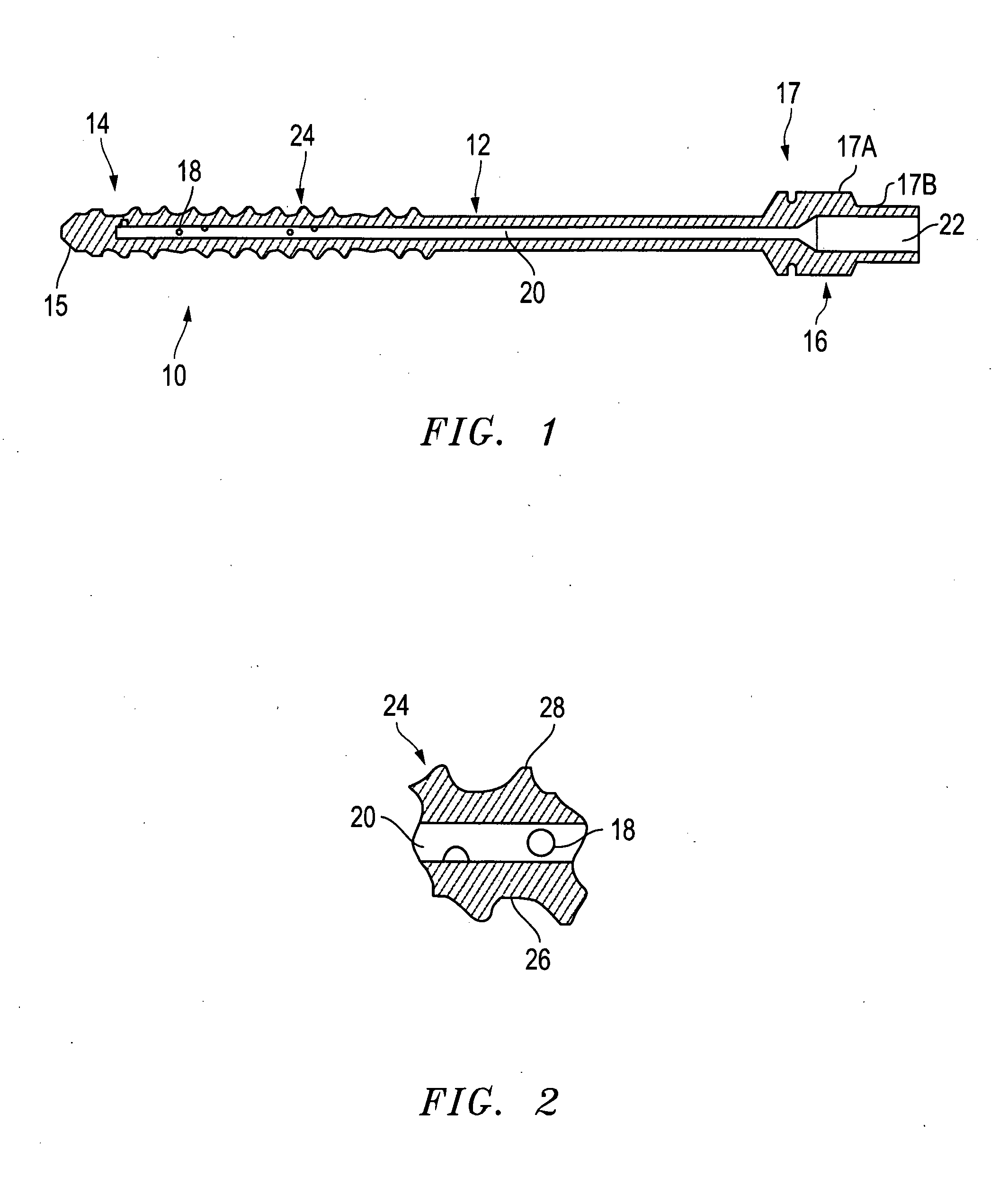 Distraction pins for fluid aspiration