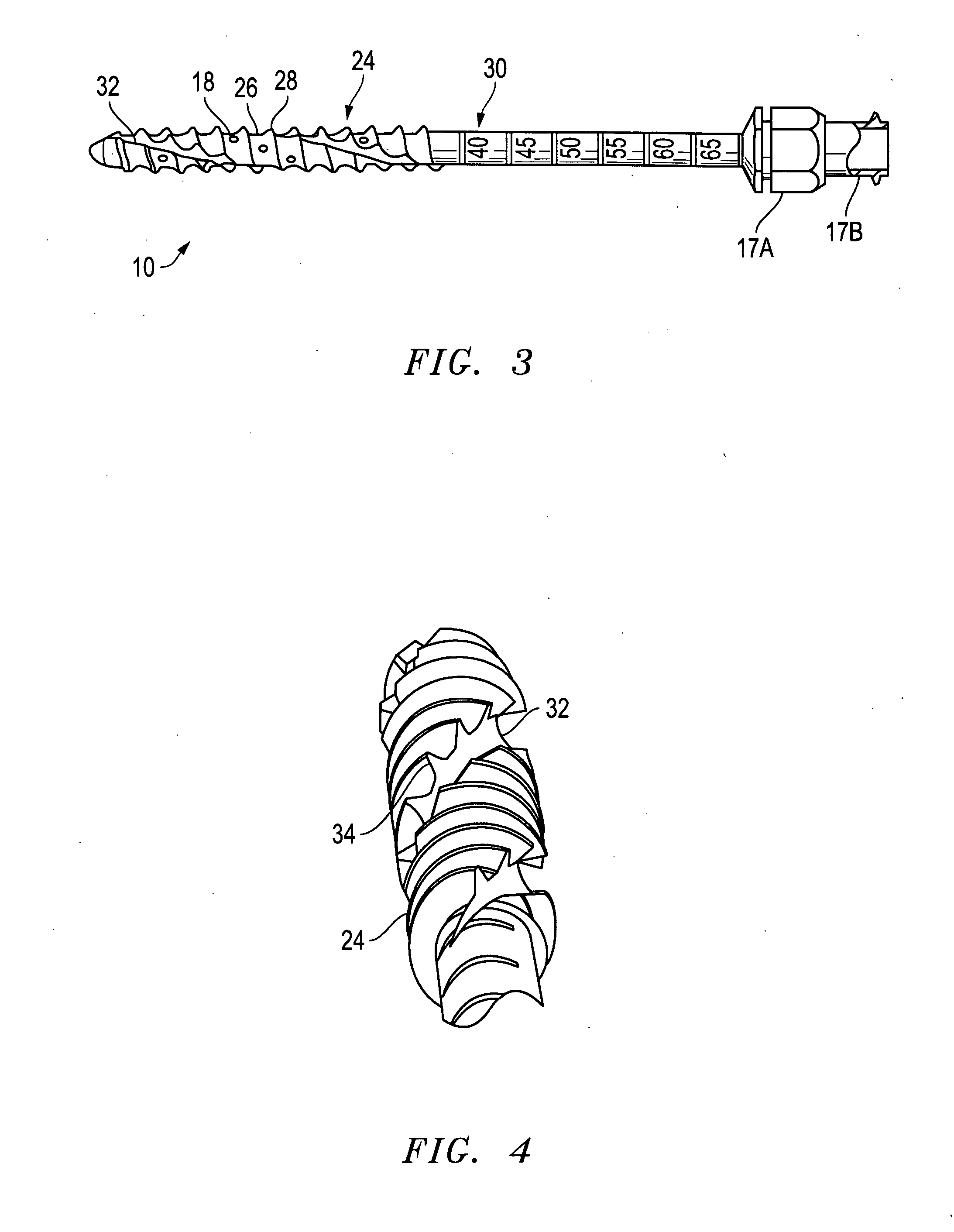 Distraction pins for fluid aspiration