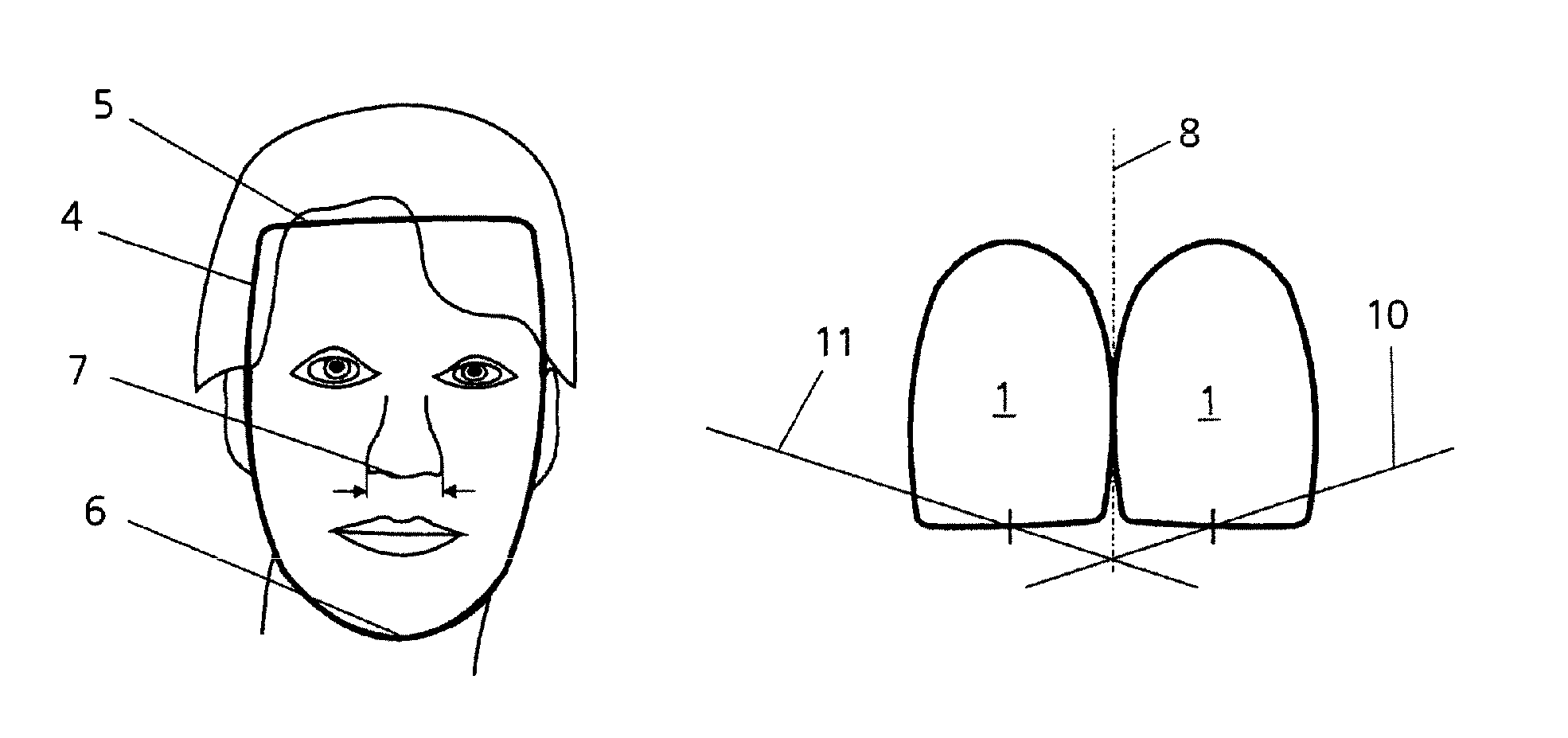 Method for reconstruction of teeth